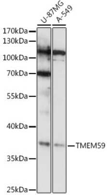 Western Blot: TMEM59 Antibody [NBP3-04988] - Western blot analysis of extracts of various cell lines, using TMEM59 antibody (NBP3-04988) at 1:1000 dilution. Secondary antibody: HRP Goat Anti-Rabbit IgG (H+L) at 1:10000 dilution. Lysates/proteins: 25ug per lane. Blocking buffer: 3% nonfat dry milk in TBST. Detection: ECL Basic Kit. Exposure time: 15s.